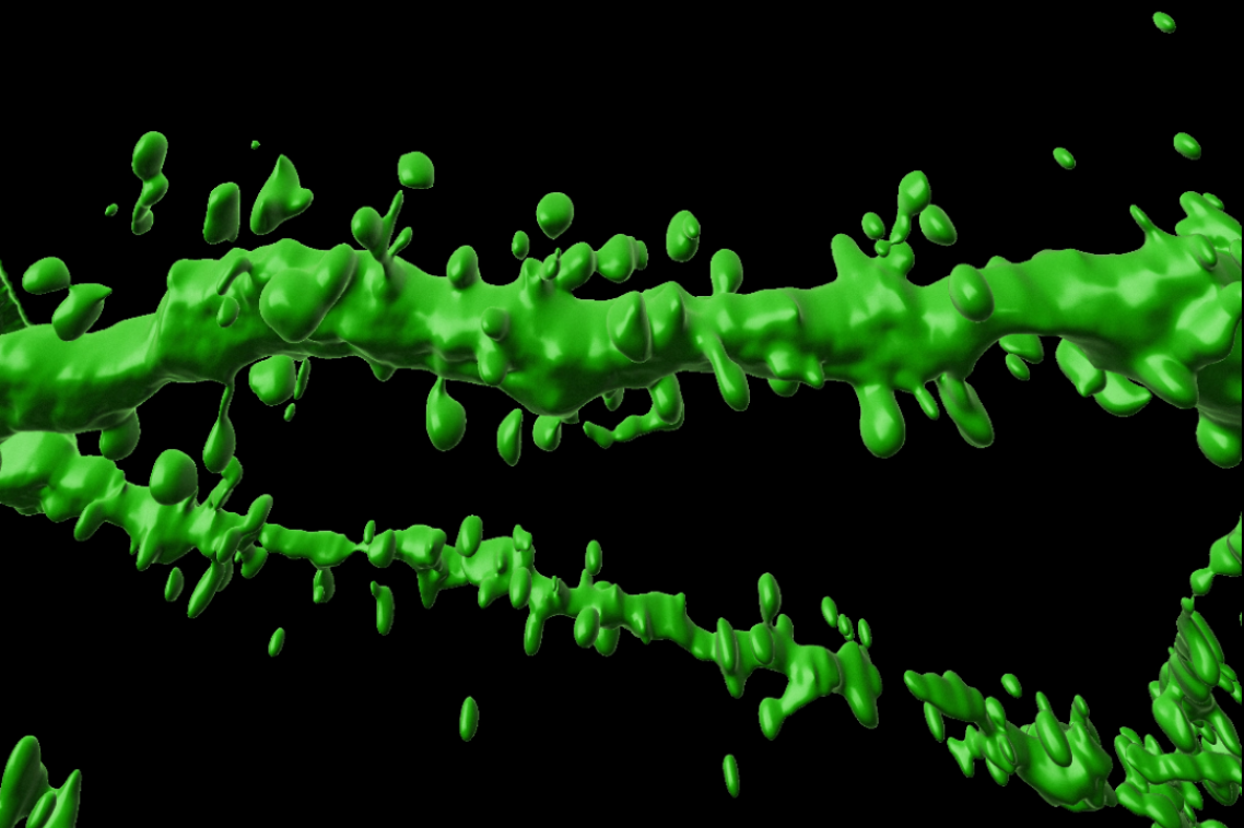 Graphic depiction of dendritic spines 